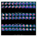 Figure 37