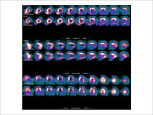 Figure 37
