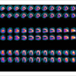 Figure 39
