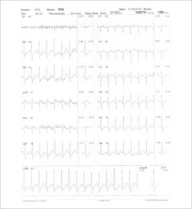 Figure 41