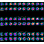 Figure 42