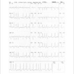 Figure 43