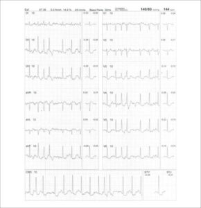 Figure 43