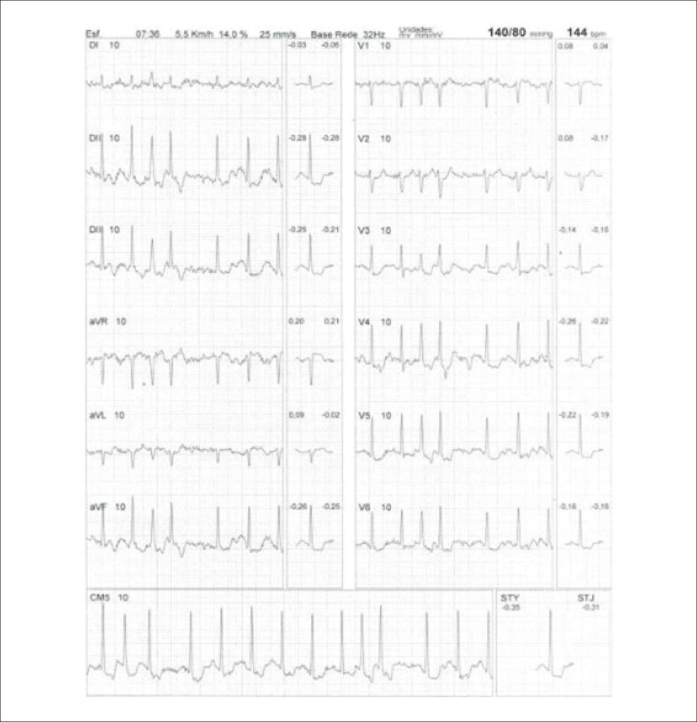 Figure 43