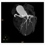 Figure 45