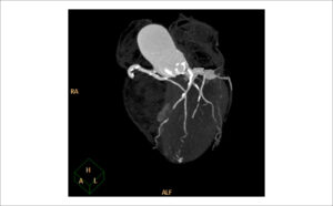 Figure 45