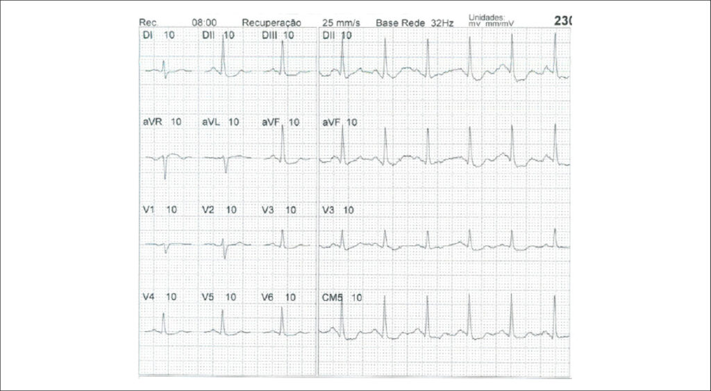 Figure 46