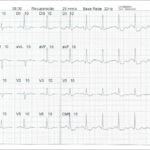 Figure 46