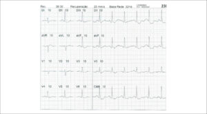 Figure 46