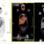 Figure 57