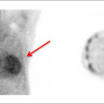 Figure 61