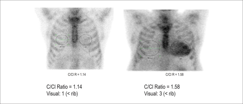 Figure 62