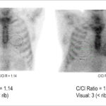 Figure 62