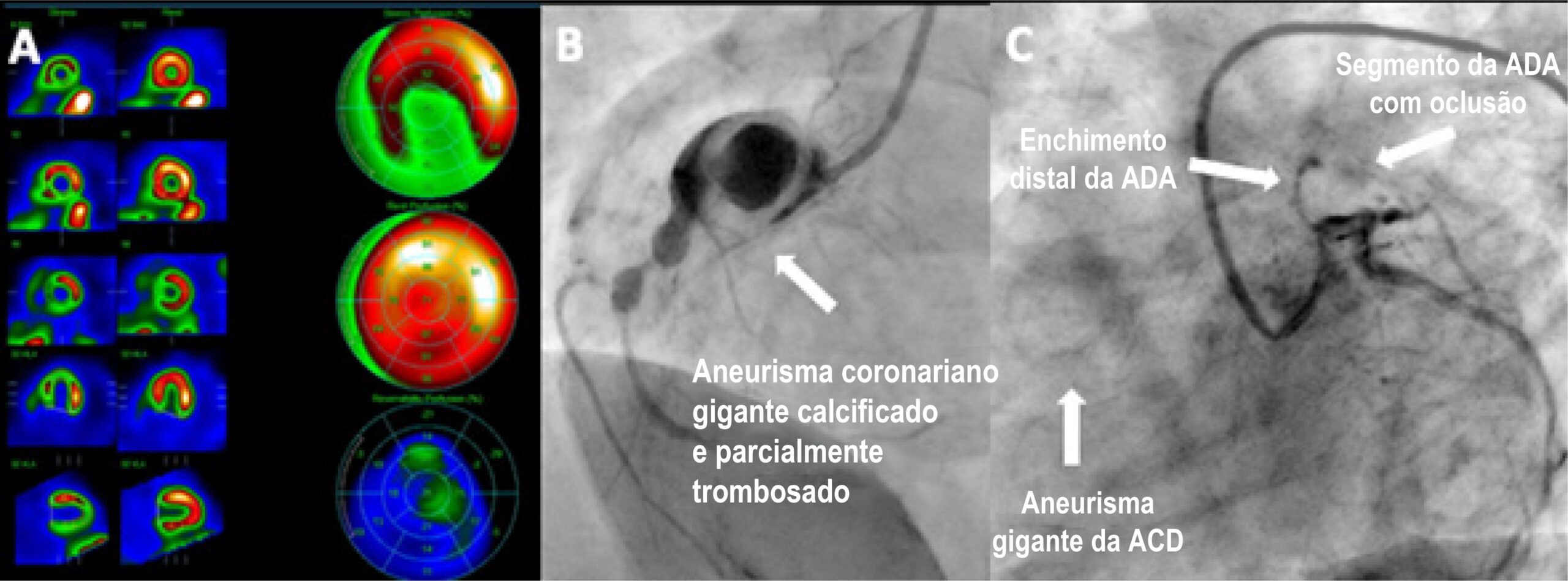 Figura 1