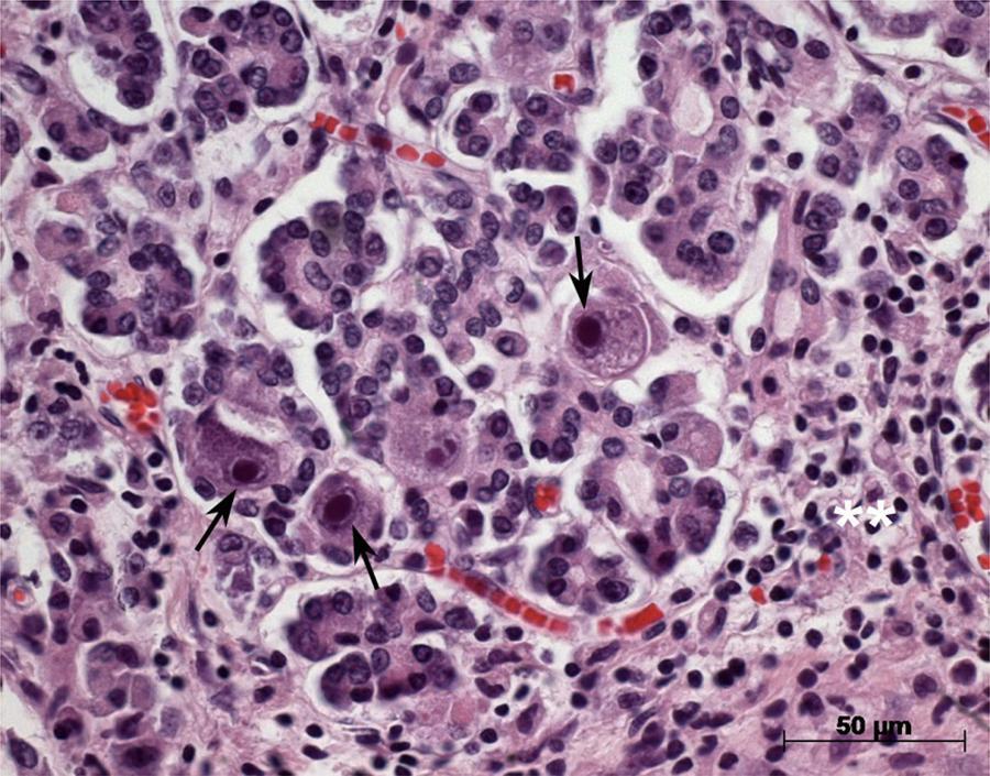 Figura 11