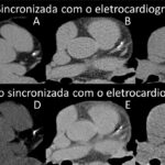 Figura 4