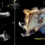 Figura 1