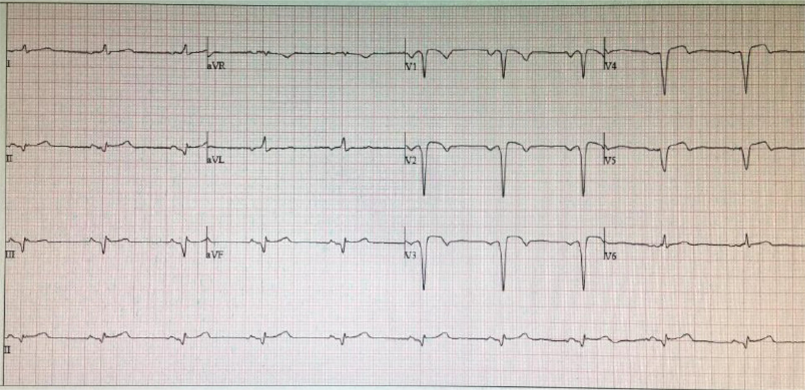 Figura 1