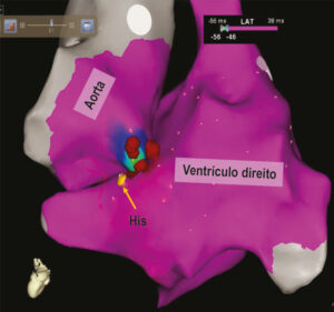 Figura 2