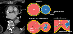Figura 3