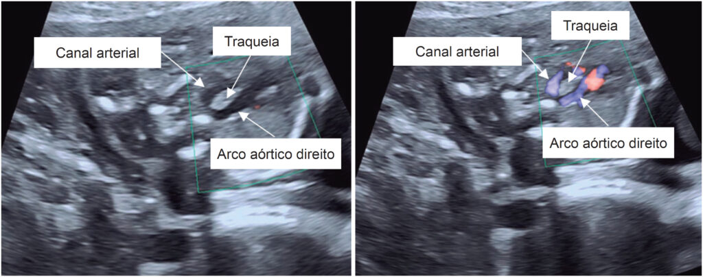Figura 1