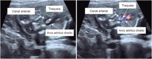 Figura 1