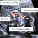 Figura 2