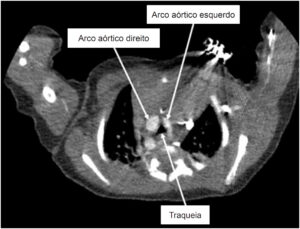 Figura 4