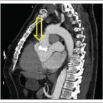 Figura 1