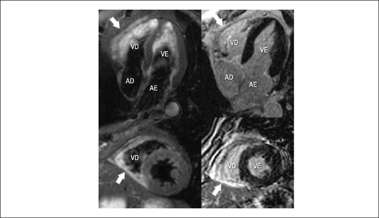 Figura 2