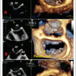 Figura 1