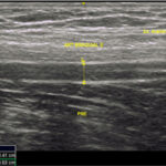 Figura 1