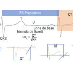 Figura 1