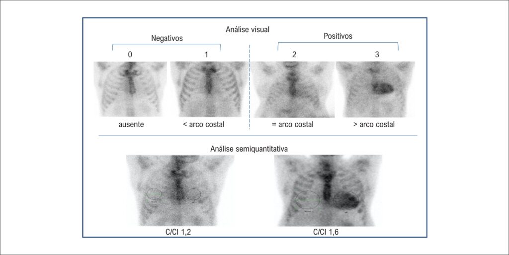 Figura 9