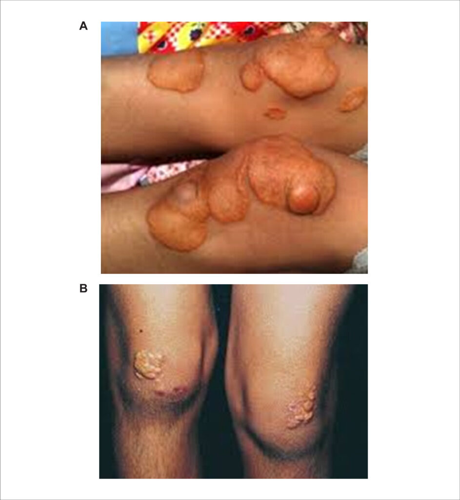 Figure 3 (A e B)