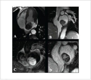 Figure 14