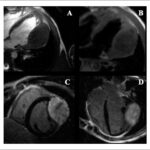 Figure 18