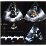 Figure 21