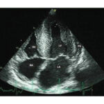 Figure 22