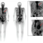 Figure 25
