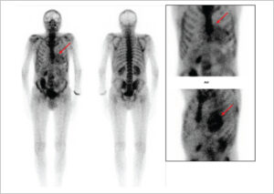 Figure 25