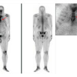 Figure 26
