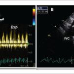 Figure 30