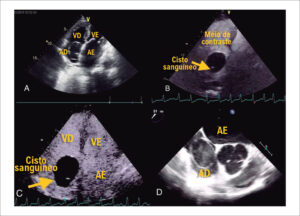 Figura 1
