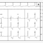 Figura 2