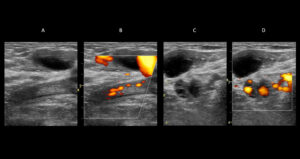 Figure 11