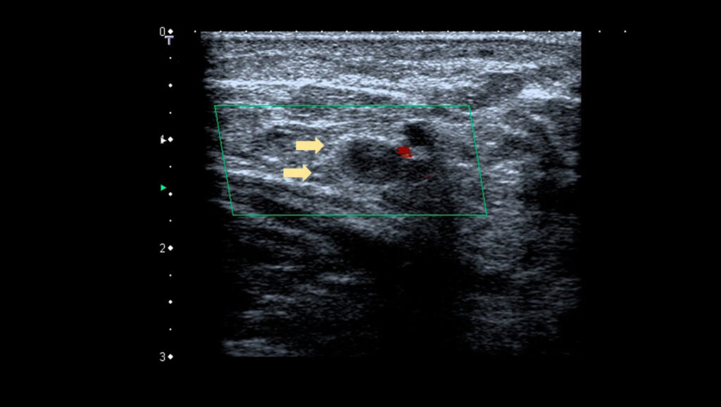 Figure 12