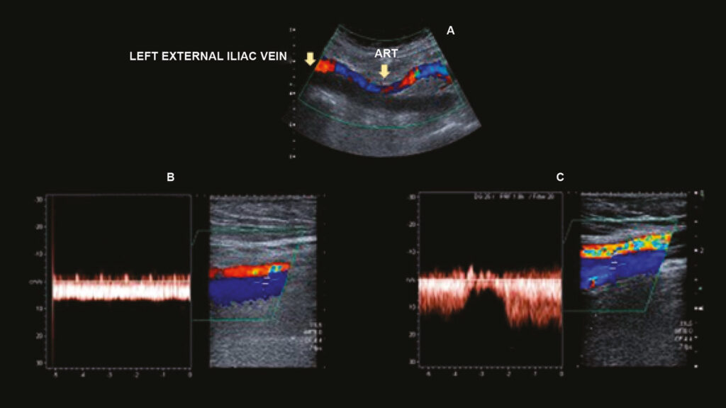 Figure 13
