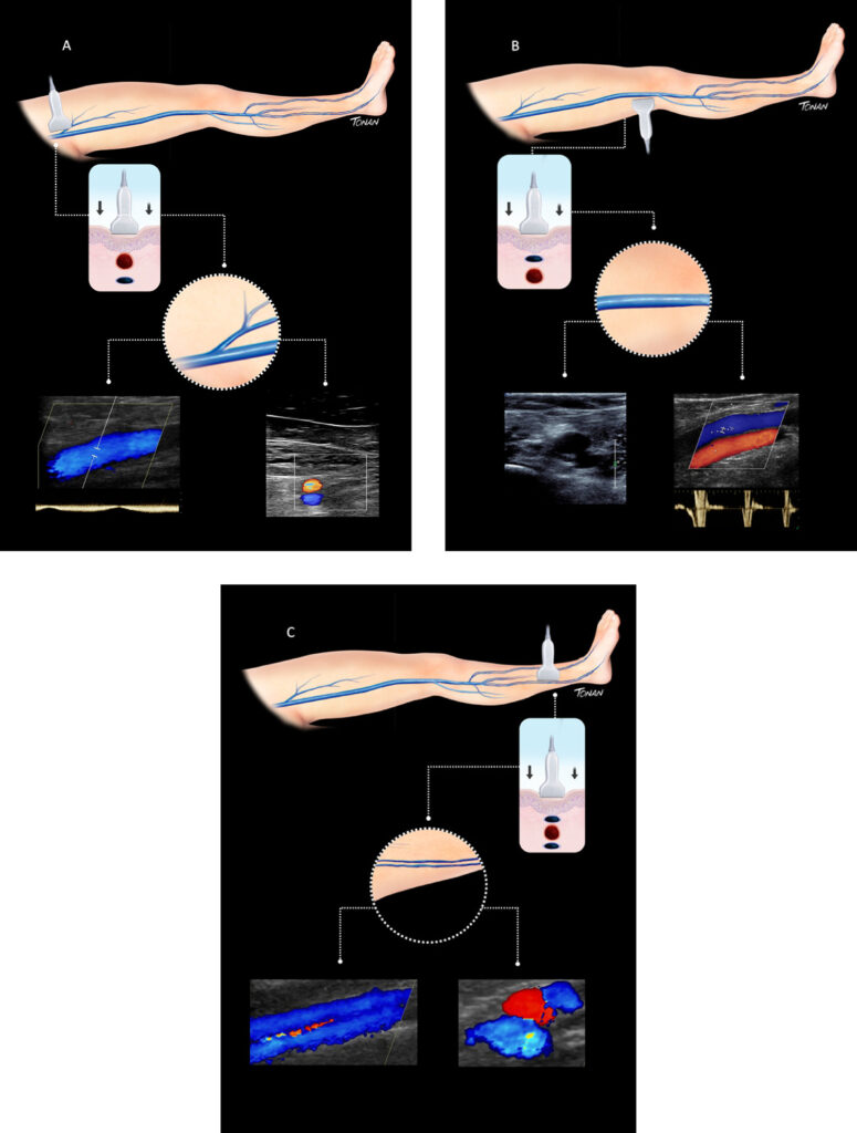 Figure 14