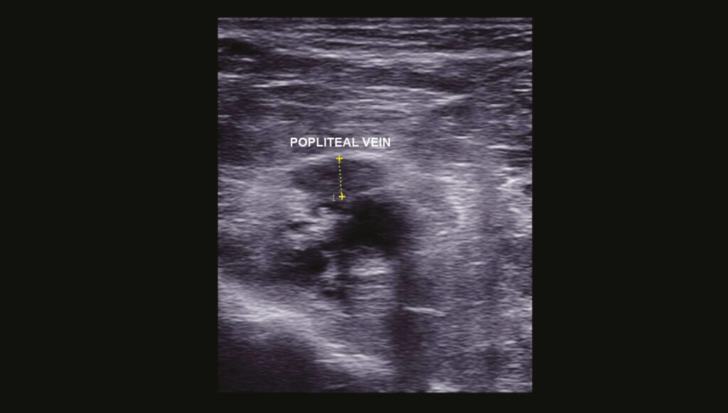 Figure 18